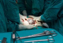 Ретроцервикальный эндометриоз: диагностика и лечение