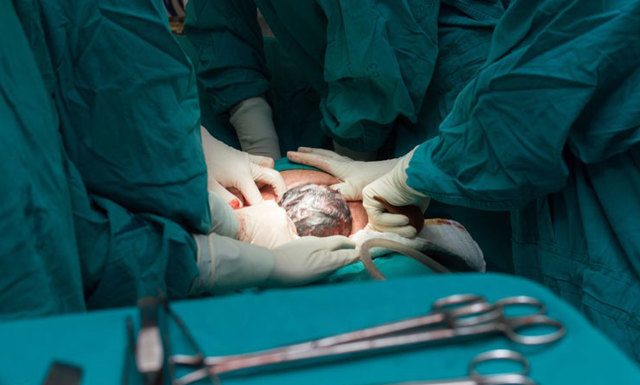 Ретроцервикальный эндометриоз: диагностика и лечение