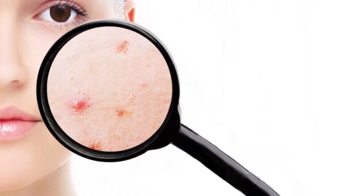 Процедуры по лицу: в каком возрасте бывает проблемная кожа и как бороться с ее недостатками, европейский бренд лечебной косметики и его продукция