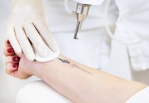 Как удалить татуировку и перманентный макияж без боли