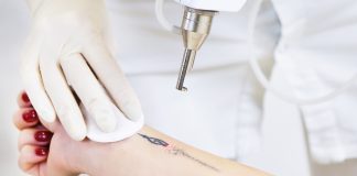 Как удалить татуировку и перманентный макияж без боли