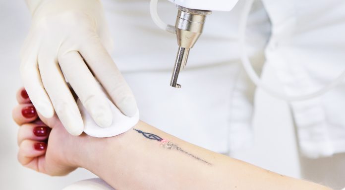 Как удалить татуировку и перманентный макияж без боли