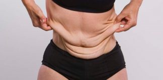 Устранение тугора кожи после похудения и беременности