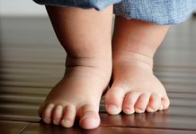 Лечение детской косолапости: комфорт ребенка при ношении брейсов