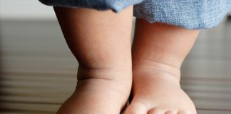 Лечение детской косолапости: комфорт ребенка при ношении брейсов