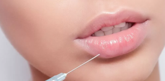 Контурная пластика губ: все, что вам нужно знать