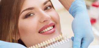 Что такое керамические виниры для зубов?