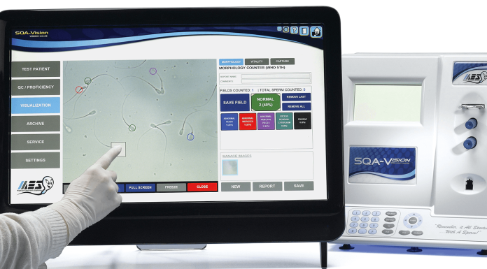 Сферы применения, виды и плюсы анализаторов спермы