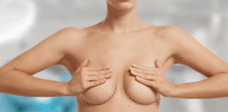 Эстетические и функциональные аспекты маммопластики: как правильно выбрать метод операции