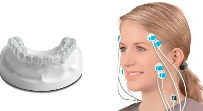 Почему важно лечить бруксизм: последствия для здоровья зубов и организма