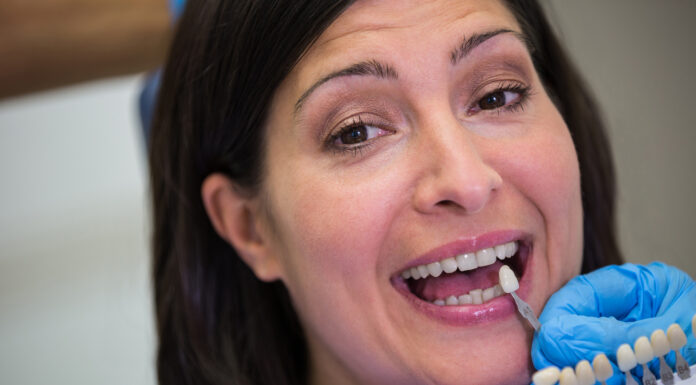 Имплантация зубов в Балашихе: почему это удобно и выгодно для пациентов